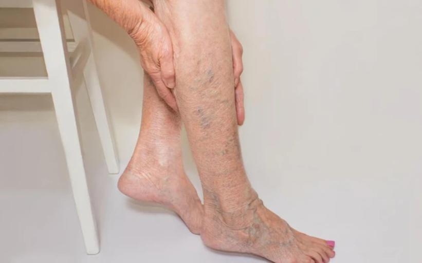 Có nhiều phương pháp giúp chẩn đoán huyết khối tĩnh mạch