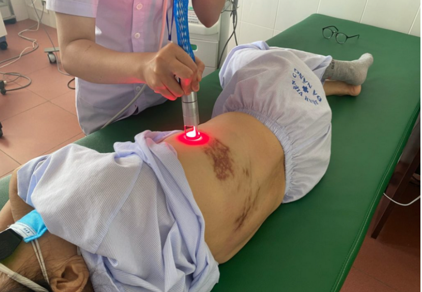 Sử dụng ánh sáng laser là phương pháp vật lý trị liệu cho bệnh nhân đột quỵ